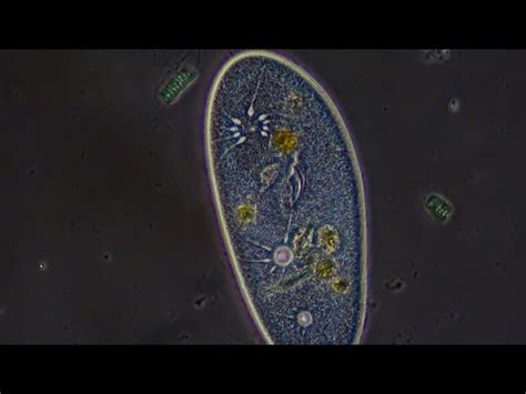   Paramecium – En mystisk mikrokosmos med vinglar och virvlande rörelser!